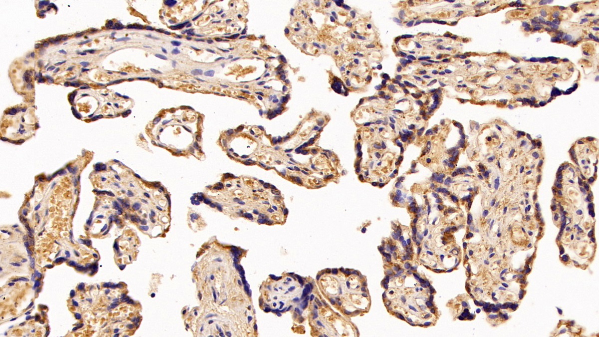 Polyclonal Antibody to Pregnancy Associated Plasma Protein A (PAPPA)