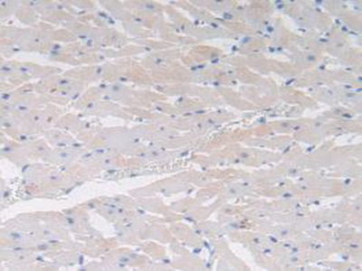 Polyclonal Antibody to Cholecystokinin (CCK)