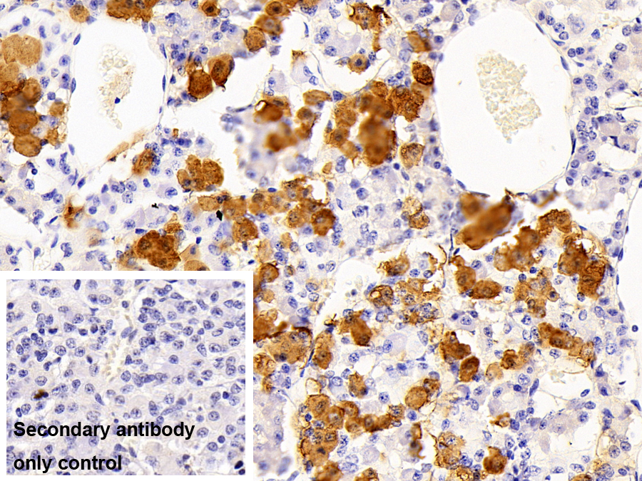 Polyclonal Antibody to Beta-Endorphin (bEP)