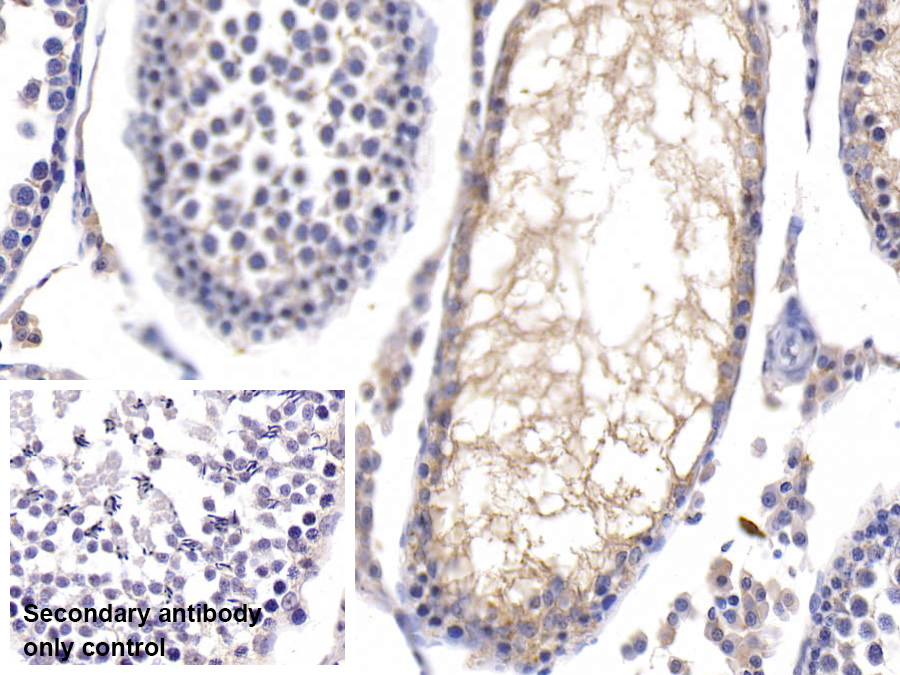 Polyclonal Antibody to Fucosidase Alpha L1, Tissue (FUCa1)