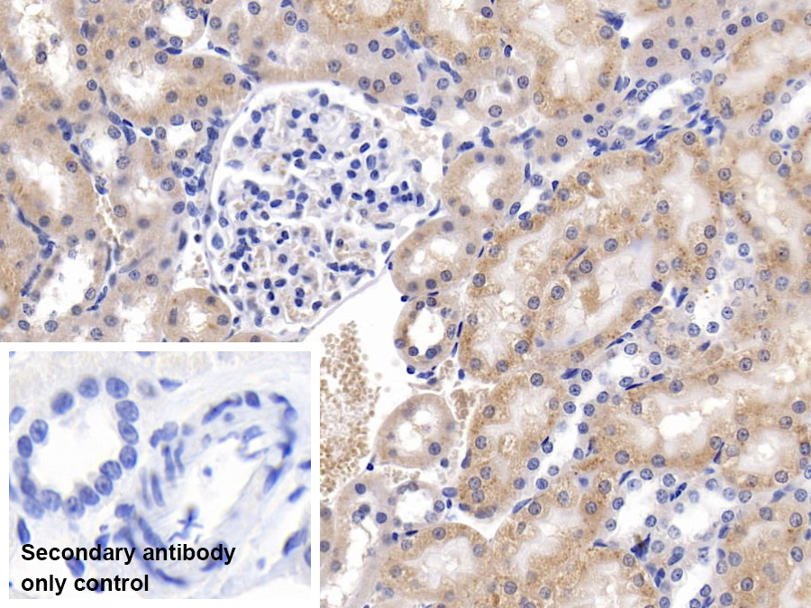 Polyclonal Antibody to Fucosidase Alpha L1, Tissue (FUCa1)