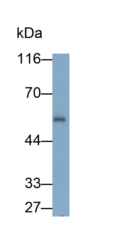 Polyclonal Antibody to Fucosidase Alpha L1, Tissue (FUCa1)