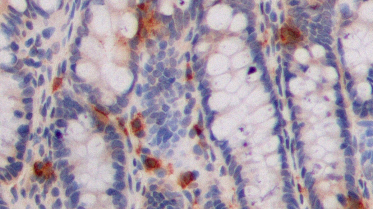 Polyclonal Antibody to 5-Hydroxytryptamine (5-HT)