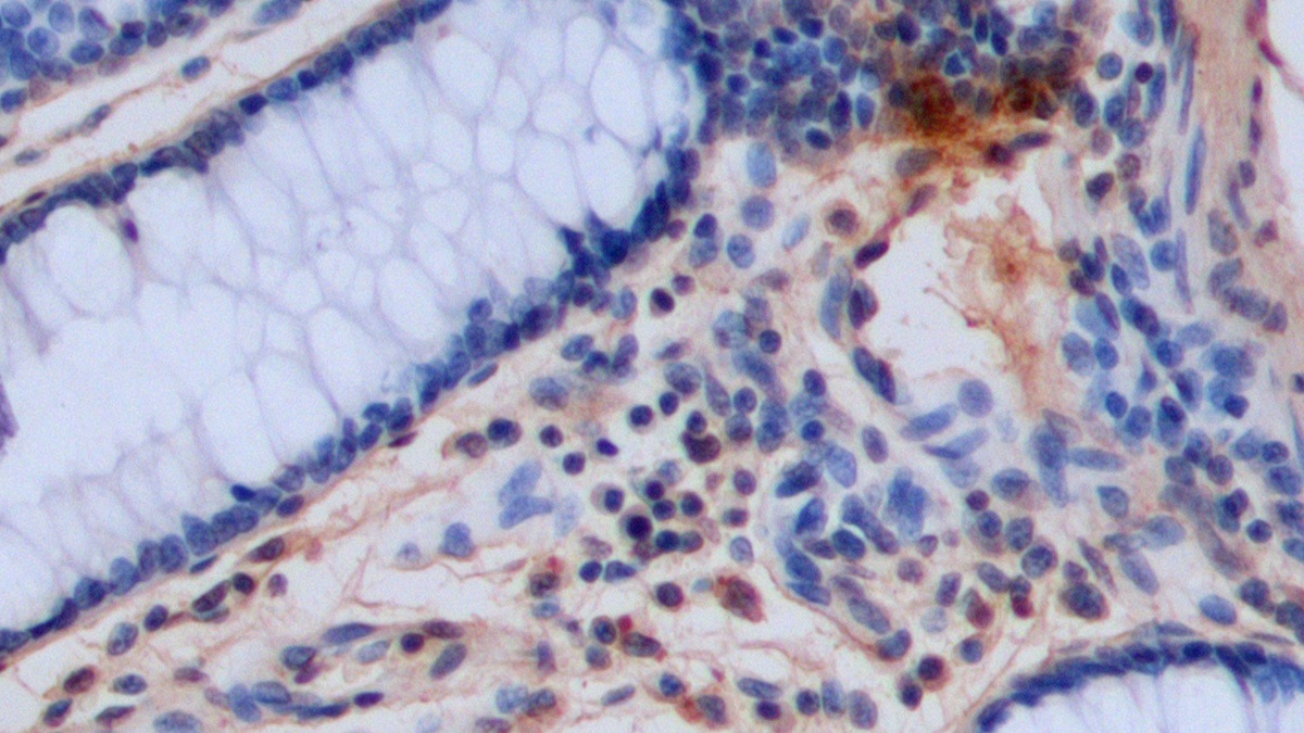 Polyclonal Antibody to 5-Hydroxytryptamine (5-HT)