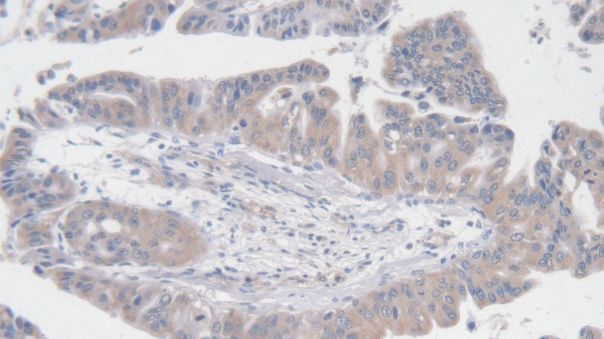 Polyclonal Antibody to Angiotensin I (AngI)