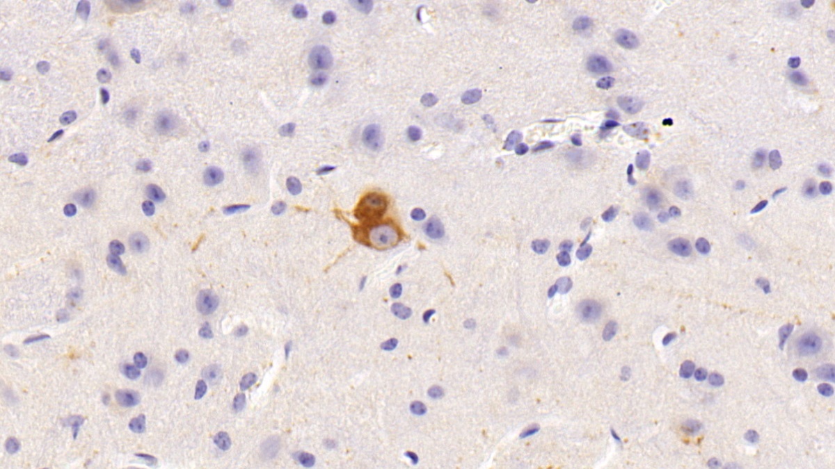 Polyclonal Antibody to Nitric Oxide Synthase 1, Neuronal (NOS1)