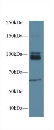 Polyclonal Antibody to Nitric Oxide Synthase 1, Neuronal (NOS1)