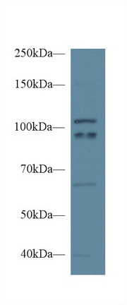 Polyclonal Antibody to Nitric Oxide Synthase 1, Neuronal (NOS1)