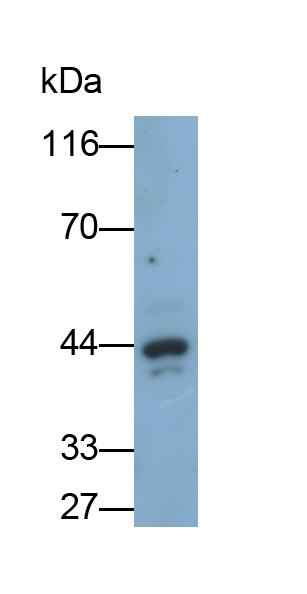 Polyclonal Antibody to Alpha-1-Acid Glycoprotein (a1AGP)