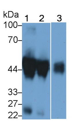 Polyclonal Antibody to Alpha-1-Acid Glycoprotein (a1AGP)