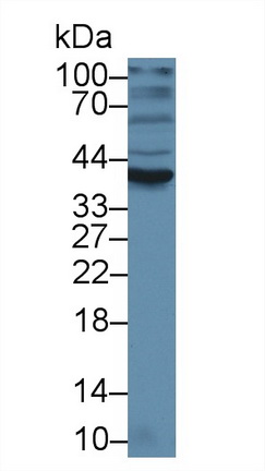 Polyclonal Antibody to Alpha-1-Acid Glycoprotein (a1AGP)