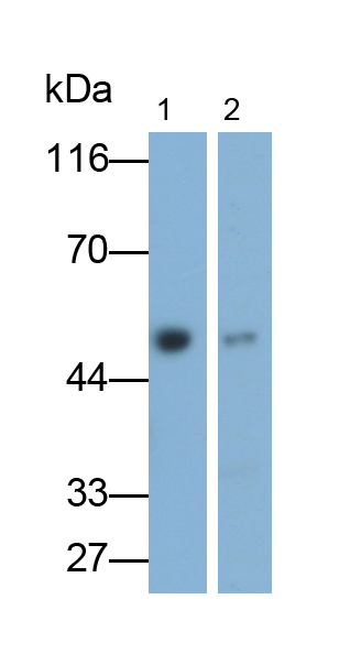 Polyclonal Antibody to Alpha-1-Acid Glycoprotein (a1AGP)