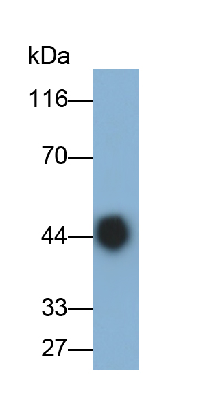 Polyclonal Antibody to Alpha-1-Acid Glycoprotein (a1AGP)
