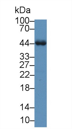 Polyclonal Antibody to Alpha-1-Acid Glycoprotein (a1AGP)