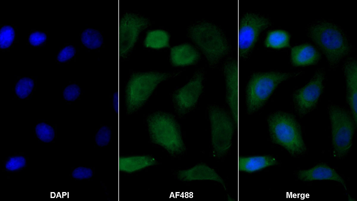 Polyclonal Antibody to Haptoglobin (Hpt)