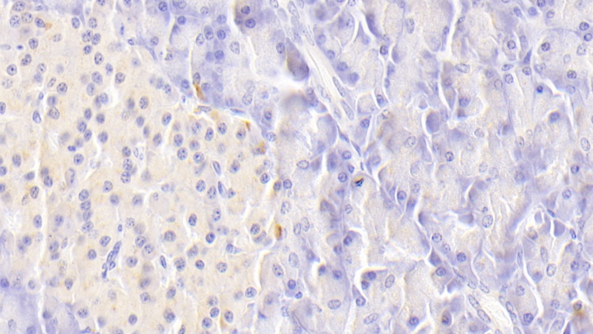 Polyclonal Antibody to Death receptor 5 (DR5)