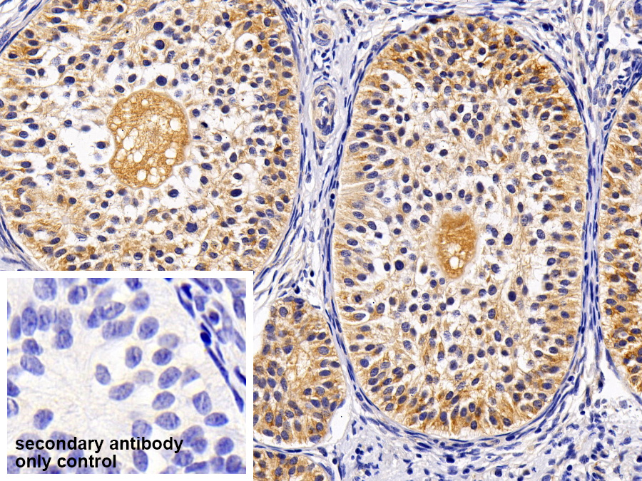 Polyclonal Antibody to Death receptor 5 (DR5)