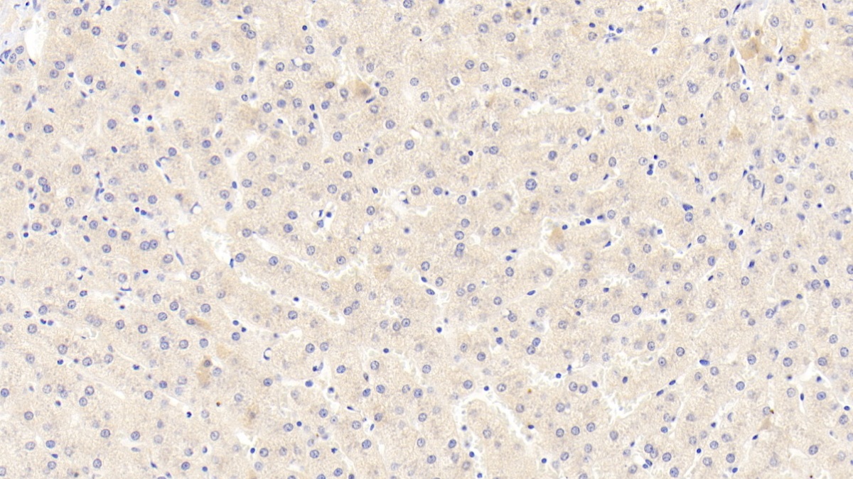 Polyclonal Antibody to Coagulation Factor II (F2)