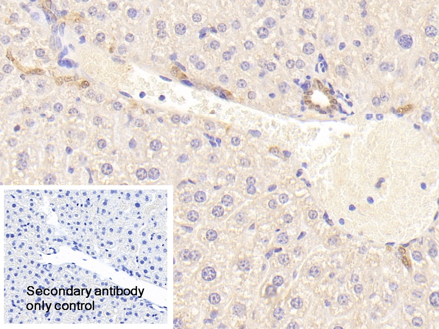 Polyclonal Antibody to Coagulation Factor II (F2)