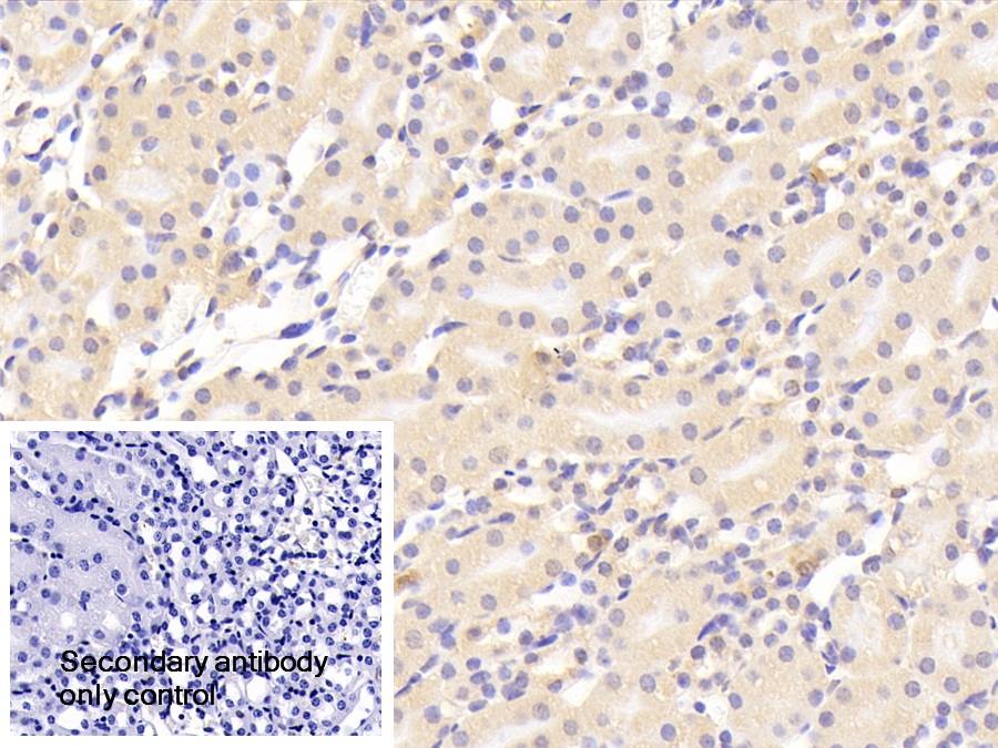 Polyclonal Antibody to Coagulation Factor II (F2)