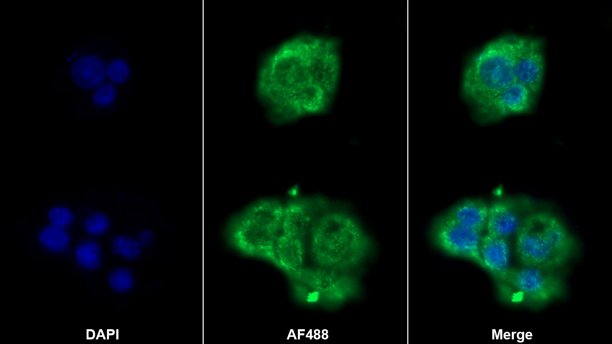 Polyclonal Antibody to Coagulation Factor II (F2)