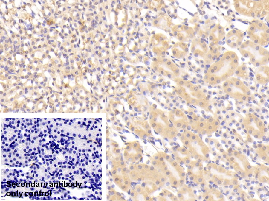 Polyclonal Antibody to Coagulation Factor II (F2)