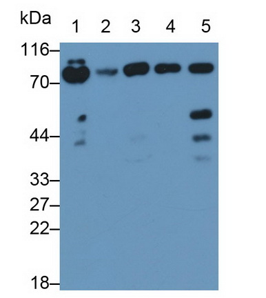 Polyclonal Antibody to Coagulation Factor II (F2)