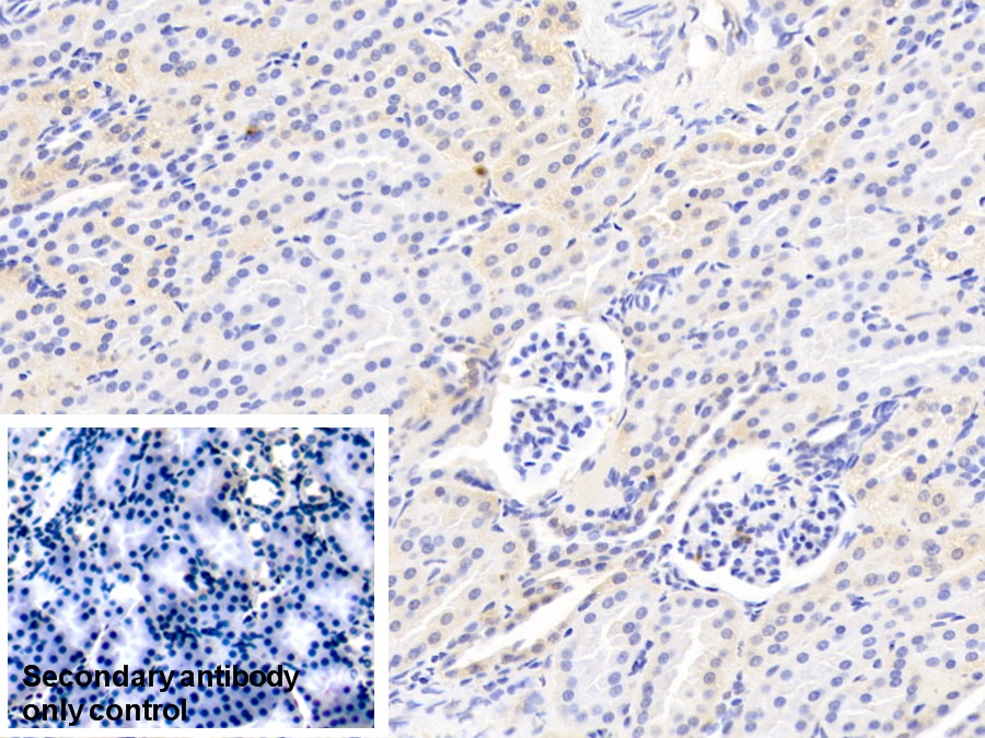 Polyclonal Antibody to Coagulation Factor II (F2)