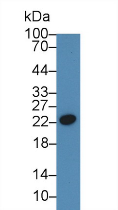 Polyclonal Antibody to C Reactive Protein (CRP)