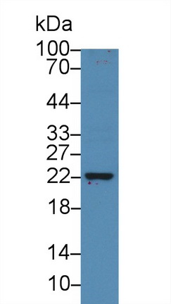 Polyclonal Antibody to C Reactive Protein (CRP)