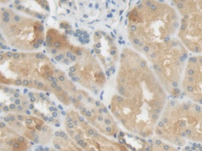 Polyclonal Antibody to C Reactive Protein (CRP)