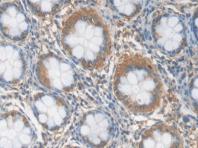 Polyclonal Antibody to C Reactive Protein (CRP)