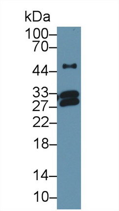 Polyclonal Antibody to C Reactive Protein (CRP)