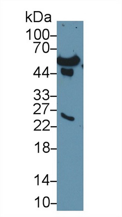 Polyclonal Antibody to C Reactive Protein (CRP)