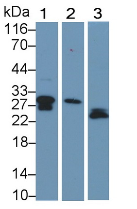 Polyclonal Antibody to C Reactive Protein (CRP)