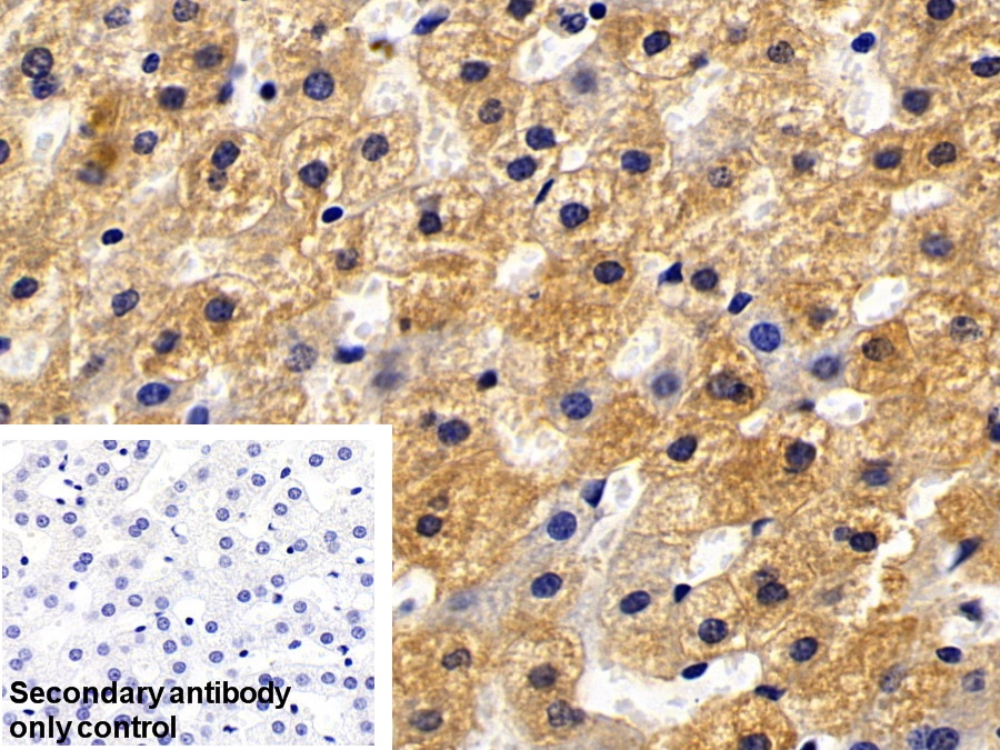 Polyclonal Antibody to C Reactive Protein (CRP)