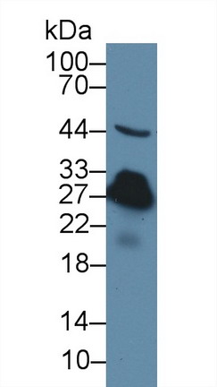 Polyclonal Antibody to C Reactive Protein (CRP)