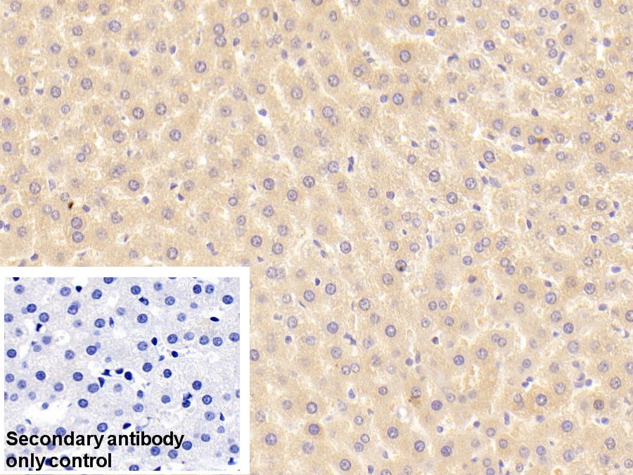 Polyclonal Antibody to C Reactive Protein (CRP)