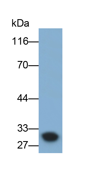 Polyclonal Antibody to C Reactive Protein (CRP)