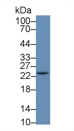 Polyclonal Antibody to C Reactive Protein (CRP)