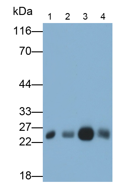 Polyclonal Antibody to C Reactive Protein (CRP)