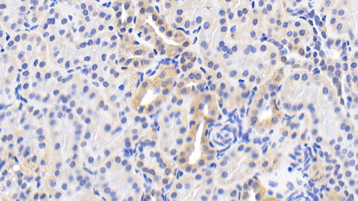 Polyclonal Antibody to Heat Shock Protein 60 (Hsp60)