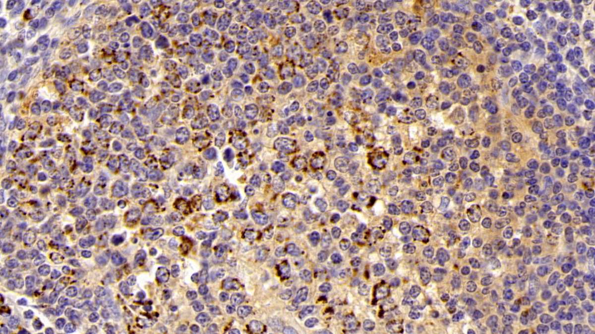 Polyclonal Antibody to Heat Shock Protein 60 (Hsp60)
