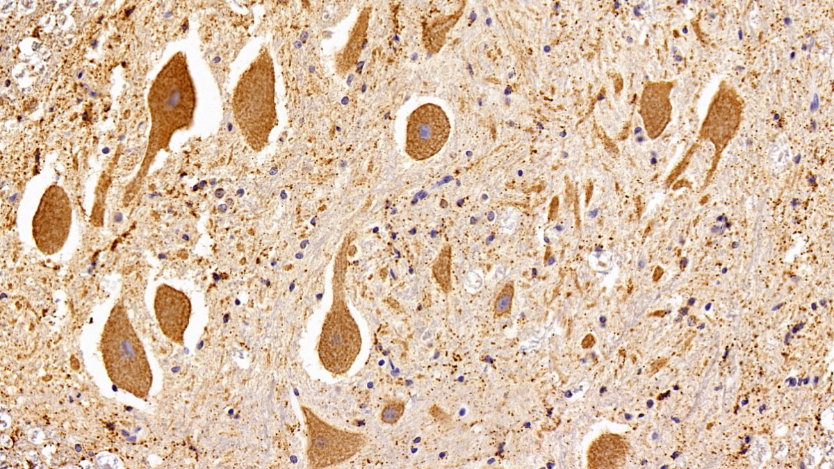 Polyclonal Antibody to Heat Shock Protein 60 (Hsp60)