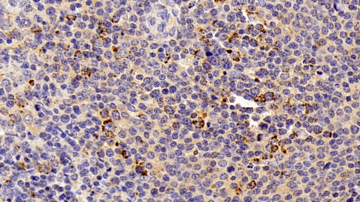 Polyclonal Antibody to Heat Shock Protein 60 (Hsp60)