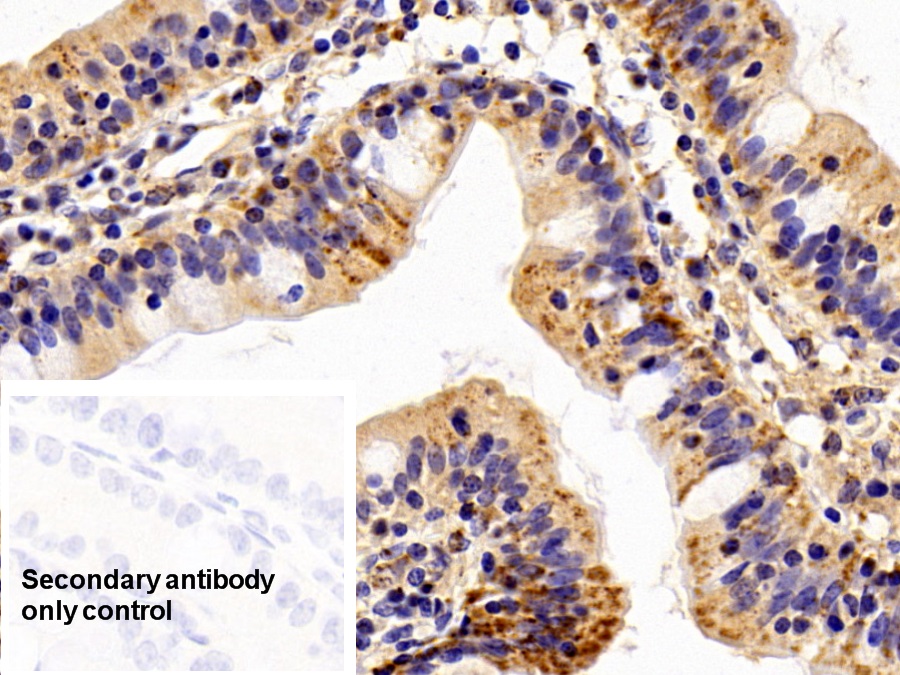 Polyclonal Antibody to Heat Shock Protein 60 (Hsp60)