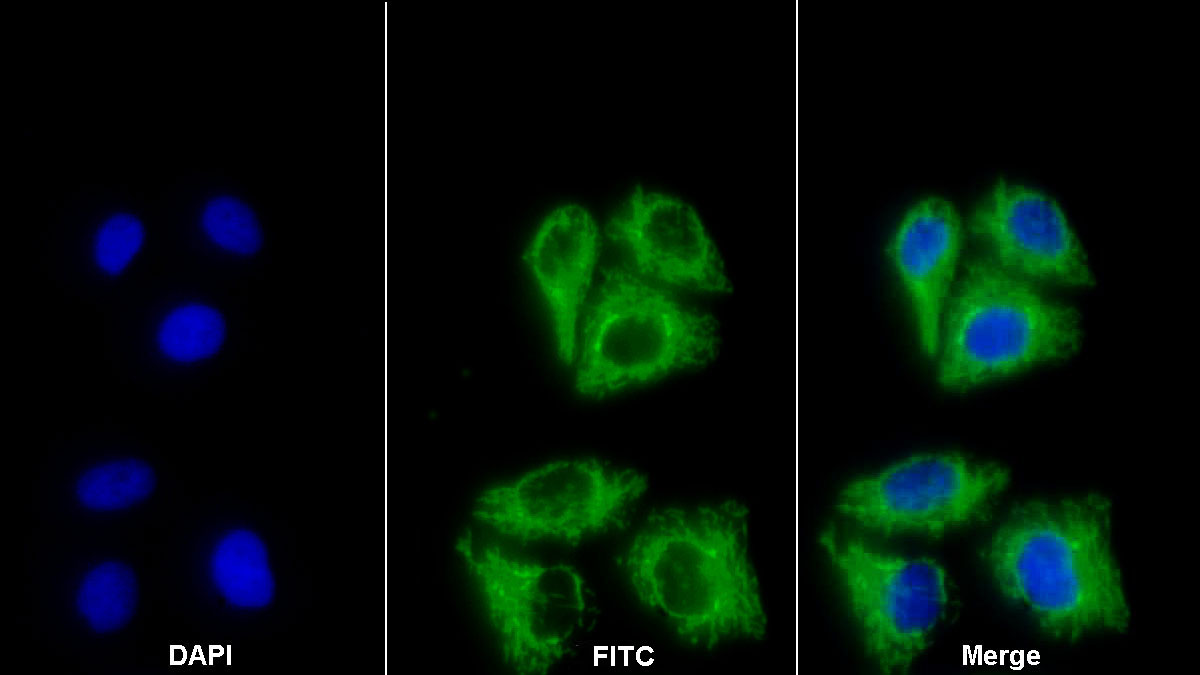 Polyclonal Antibody to Heat Shock Protein 60 (Hsp60)