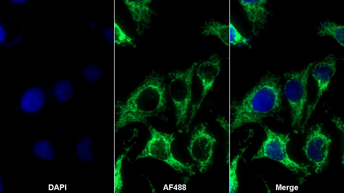 Polyclonal Antibody to Heat Shock Protein 60 (Hsp60)