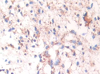 Polyclonal Antibody to Heat Shock Protein 60 (Hsp60)