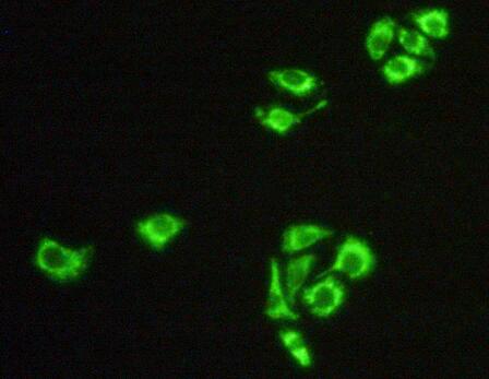 Polyclonal Antibody to Heat Shock Protein 60 (Hsp60)